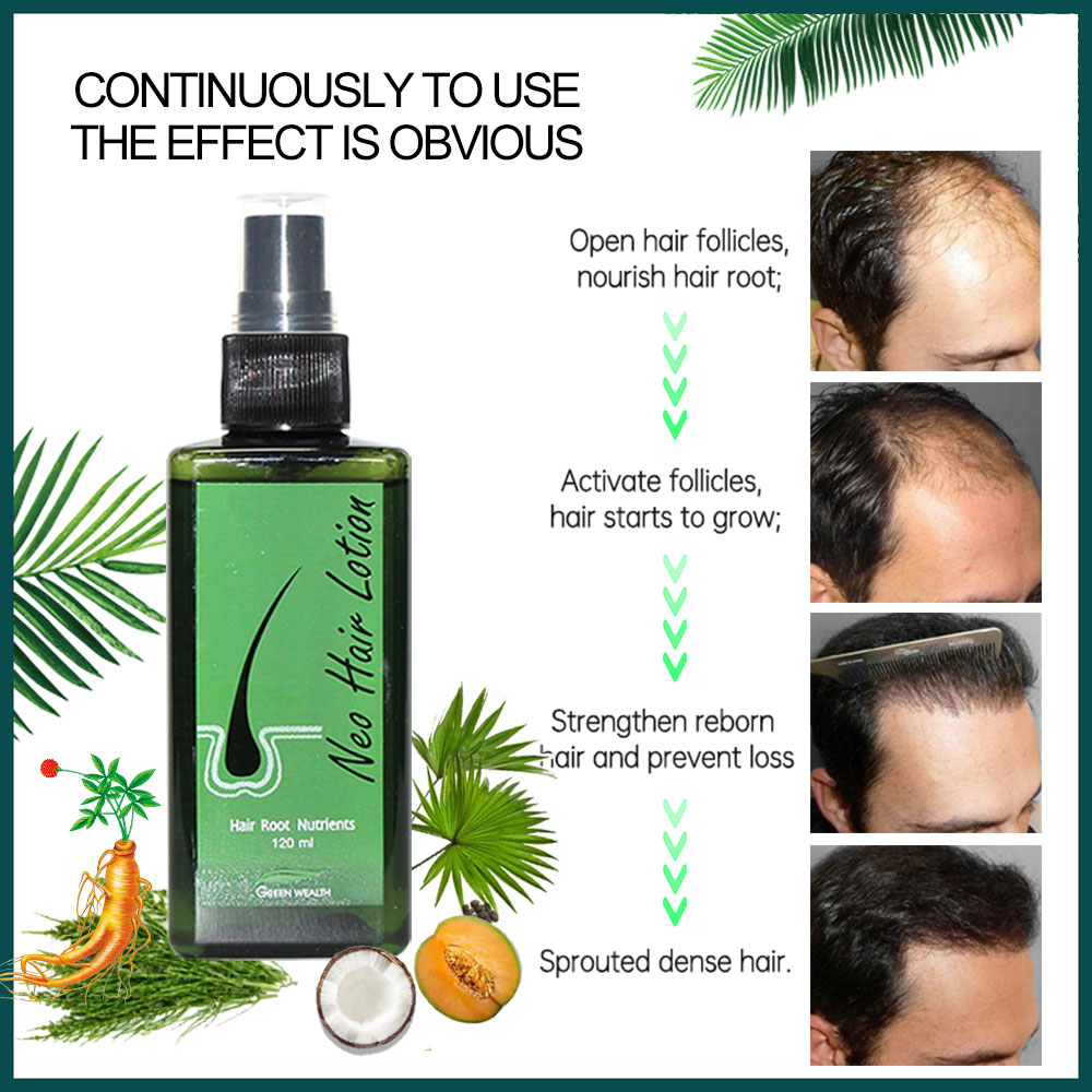 4 pcs Neo Hair Lotion 120ml Ca - Nutrition And Fitness ulasan dan harga